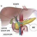 췌장암 4기 환자 항암 치료를 중단하고 싶을 때 이미지