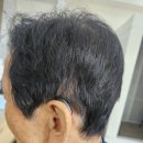 서울탑보청기 이미지