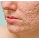 강남유앤아이의원 | 강남역 포텐자, 후기 정말일지 궁금하다면