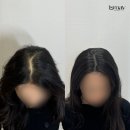 이즈메이 부산본점 | 부산탈모, 두피문신으로 감추지말고 바꾸자!
