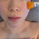 셀앤비에스테틱강남지점 | 선릉 셀앤비에스테틱 얼굴전체 피지 필링관리 후기, 선릉 피부관리, 강남 피지관리