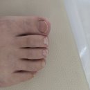 뮬랑네일 | 대전 문제성 발톱 관리 잘하는 곳 뮬랑네일에서 발톱 관리받은 후기