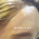 비비헤어라인