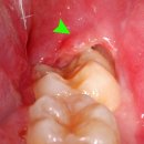 서울행복치과 이미지