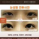 갤러리성형외과의원 이미지