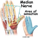 수근관 증후군의 신경스트레칭 치료법에 관한 논문. Treatment of carpal tunnel syndrome 이미지