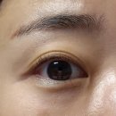 눈주름 관리 : 압토솔 오팔덤 아이크림