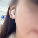 📍 초이스 뷰티 | 미백보습관리 | 색소 제거 | 메디컬 스킨케어 전문샵 | 솔직 후기