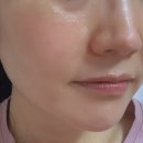 글로벌메디텍 | 피부과/에스테틱 입점 제품! 몬퓨리엘 올인원 수분앰플로 속건조 잡기