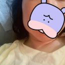 [삼전/석촌치과]서울오브치과병원 매복 사랑니 발치 후기