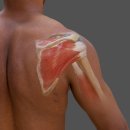 연세우리병원 | [잠실 정형외과 연세우리병원] 회전근개 파열 치료! 어깨 회전근개 봉합술과 브릿지 패치 보강술