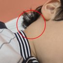 대구 중구 이비인후과 [더맑은이비인후과의원] 소아 초음파 검사 가능 병원