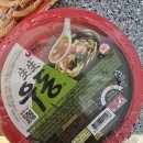 테라스치과의원 | 양쪽 매복사랑니 발치 후 일주일 후기