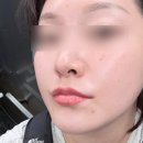 케어마인 | 평택피부관리 더마인에스테틱에서 1:1 맞춤 케어 받고 온 후기