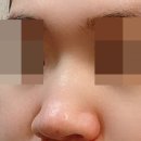 유노성형외과의원 네이버블로그