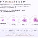 암 재활 이미지