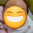 11650-7-6-5 | 임신 40주 1일 유도분만 실패 후 제왕절개 / 한빛여성병원 제왕절개 6박 7일 입원 후기 - 5~7일차