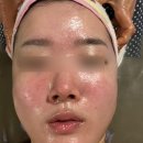이영락 | 남포동피부관리 이영란코스메틱 경락후기