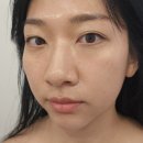 유니피부샵 이미지