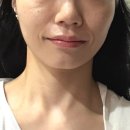 라율 | 피부관리/서울대벤처타운역피부관리] 라율테라피 윤곽관리 후기｜피부결부터 얼굴선까지 만족했던...