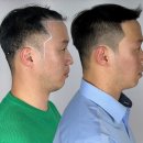 용산-169 | 용산구두피문신 본트SMP, 자연스러운 헤어라인 직접 경험 후기