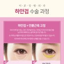 미본 이미지