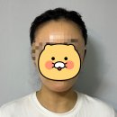 메디포올 | 메디포올 신사동 피부관리 플라즈마 리프팅 솔직 후기!