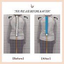 슈로스&과학운동센터 | 마석필라테스 | 척추측만 고민이라면? '슈로스' 교육 이수 전문가에게 맡겨야하는 이유!✨