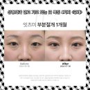 청주성형외과 믿고 가도 되는 곳 특징 4가지 &lt;공개&gt;