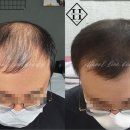 한올SMP 네이버블로그