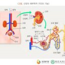 급성 신장염[acute nephritis] 이미지