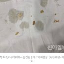 [단독] 설빙 미숫가루라떼 마신 A씨, 위내시경 받고 분통한 사연 이미지