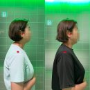 수리골길 | 강릉 필라테스 숲, 목통증 거북목 교정으로 건강한 변화 시작!