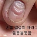 철분부족 증상 그냥 넘기지 마세요 이미지