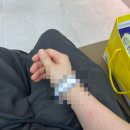 스마일안경 | 스마일라식 후기 (안경, 렌즈 인생 졸업) 고통은 단 하나도 없었던 스마일라식 추천