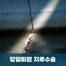 명지항외과의원 | 대구,포항 항문외과 - 치루, 수술이 무섭다면? 미추마취 기반 당일수술 및 퇴원으로, 부산 명지항외과