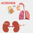 인체생리 호흡 산증 이미지