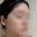 온양3동 삼동로40번길 | 청주 천안 산후마사지 마더스원 출장 산후관리 내돈내산 후기