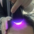 닥터포헤어전주 | [전주두피관리]두피 열감부터 잡아준 탈모관리 닥터포헤어 전주점 솔직후기