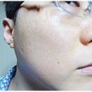 블루선 이미지