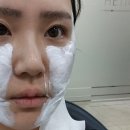 365PLUS 의정부가능점 | 의정부피부과 스킨부스터 콜라겐주사 올리디아365 8cc 볼륨 후기