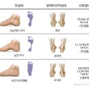 화정신발 이미지