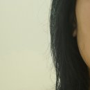 하얀결피부과의원 | 분당 피부과 분당동안의원 써마지 600샷 비수면 내돈내산 후기, 써마지 붓기