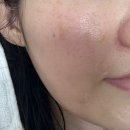 40대 홈케어앰플 추천 ‘비노트 물톡스 앰플’ 리얼후기/올영 기획전 할인정보