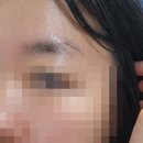 걱정말고 그려봐 | 눈썹문신 탈각 과정 콤보 타투 내돈내산 후기 광고 업체 홍보 없음