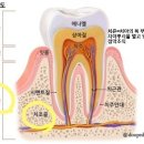 치아 신경치료로 통칭되는 치수절제술은 보험약관상 ‘수술’에 해당하지 않는다고 판결 이미지