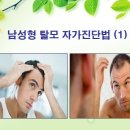더모헤어플란트 미지예피부과