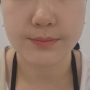 리썸에스테틱