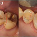 하남본치과 이미지