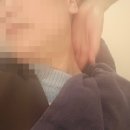 장지역(횡단보도앞) | 송파 탈모전문 모바이오 송파문정점 두피 스케일링 염증 치료 후기(내돈내산 포함)
